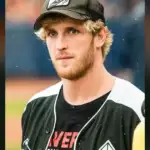 Logan Paul: I Was Wide Awake for Triceps Surgery