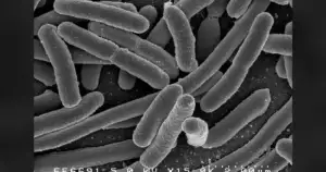 These Gut Toxin Fuel Colon Cancer under age 50